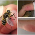 Mordida de Gadfly