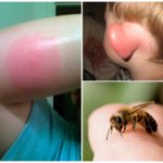 Bumblebee mordida