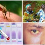 Vírus do Zika, do Nilo Ocidental e da Febre Amarela