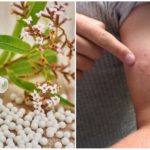 Remédios homeopáticos para uma reação negativa a picadas de mosquito