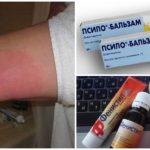 Tratamento de pés inchados com anti-histamínicos