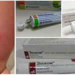 Tratamento de complicações da mordida