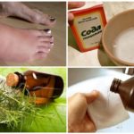 Tratamento de edema no local dos remédios populares de mordida