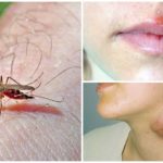 Malária e tularemia por mosquitos