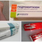 Tratamento de edema com drogas hormonais