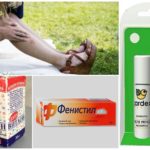 Preparações para picadas de insetos