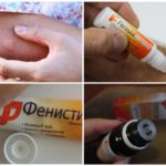 Aplicação de produtos Fenistil