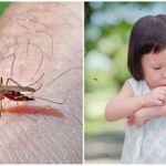 Picadas de mosquito