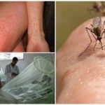 Febre do mosquito dengue e chikungunya