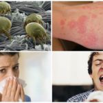 Alergia aos ácaros da cama