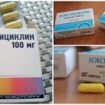 Doxiciclina para o tratamento da picada de carrapato