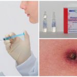 Imunoglobulina contra encefalite transmitida por carrapato