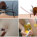 Métodos de remoção de carrapatos