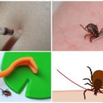 Formas de remover carrapatos