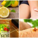 Receitas populares para picadas de mosquito