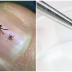 Tick