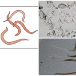 Pinworms em humanos