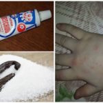 Pomada com mosquitos baunilha e mosquitos