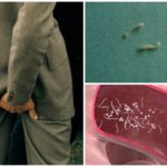 Pinworms em humanos
