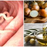 Cebola e manteiga para enterobíase