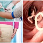 Diagnóstico de enterobiose pelo sangue