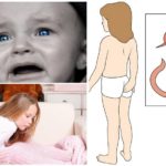 Pinworms em crianças