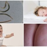Pinworms em crianças até um ano