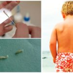Enterobiose swab