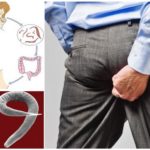 O ciclo de desenvolvimento de pinworms