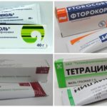 Meios para ajudar a aliviar a inflamação quando uma picada de vespa