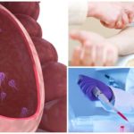Exame de sangue para Giardia