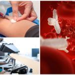 Exame de sangue para anticorpos para Giardia