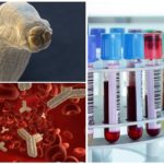 Exame de sangue para toxocarose