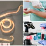 Exame de sangue para toxocarose