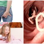 Ascaris nos intestinos