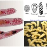 Ciclo Trematode
