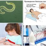 Diagnóstico de toxocaríase