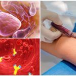 Exame de sangue para Giardia