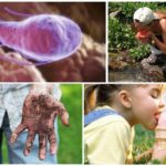 Causas da infecção por Giardia